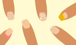 Illustration av naglar med olika problem som kan tyda på zinkbrist: fläckar, sprickor och missfärgningar.