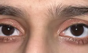 Närbild på ögon med glittrig douyin makeup i rosa toner. Ögonbrynen är mörka och buskiga.