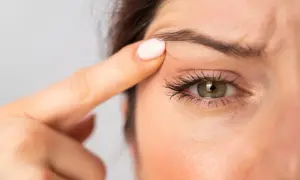 En kvinna drar upp huden vid ögat för att visa sina hooded eyes.