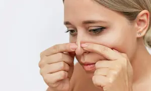 En kvinna undersöker sin näsa, där vita pormaskar syns tydligt.
