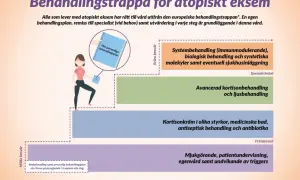 En illustration visar en trappa för behandling av eksem i ansiktet, från milda till svåra besvär.