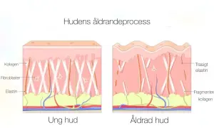 Illustration visar hur kollagen i huden bryts ner med åldern, vilket påverkar hudens elasticitet och utseende.