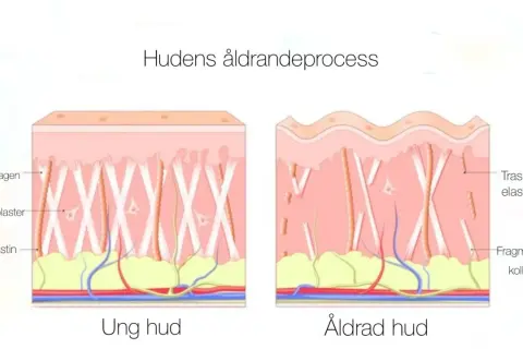 Illustration visar hur kollagen i huden bryts ner med åldern, vilket påverkar hudens elasticitet och utseende.