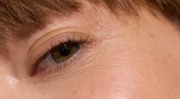 Närbild på ett öga med brun iris och mörka ögonfransar. Huden är tunn och visar fina linjer runt ögat.