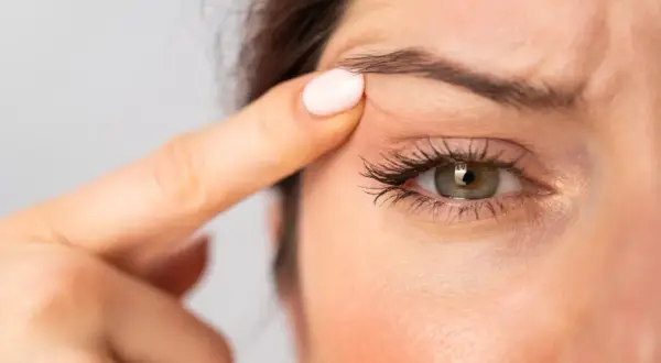 En kvinna drar upp huden vid ögat för att visa sina hooded eyes.