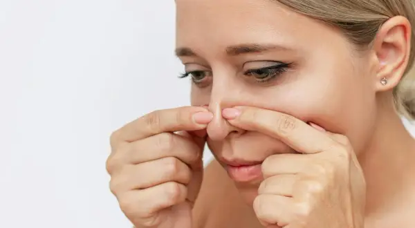 En kvinna undersöker sin näsa, där vita pormaskar syns tydligt.