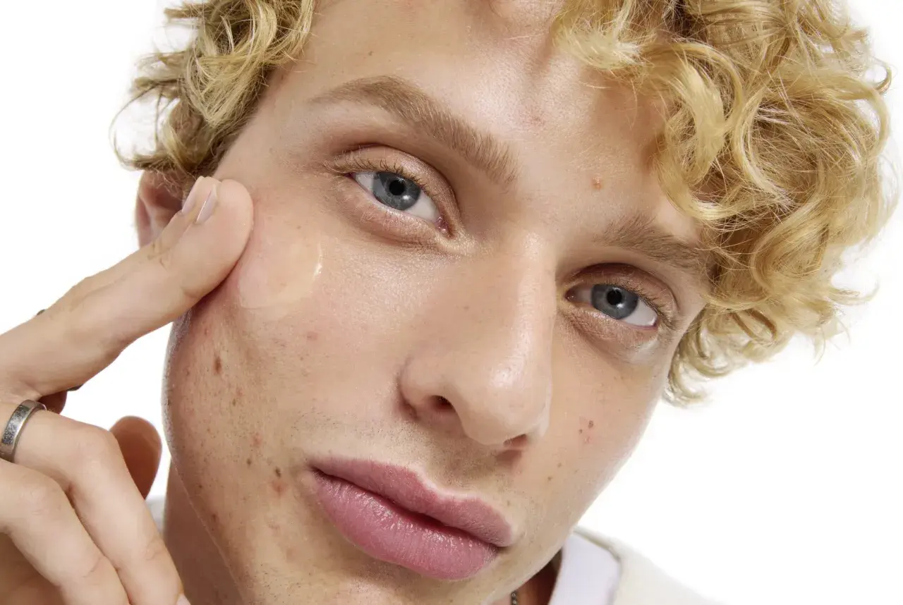 En ung man med lockigt blont hår applicerar en klar gel på kinden, en del av hans resa för att få clear skin.