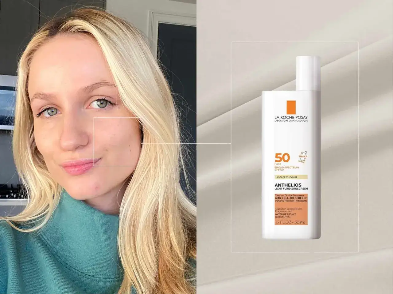 Kvinna med rosacea som använder solskydd. Niacinamid kan hjälpa till att lugna huden.
