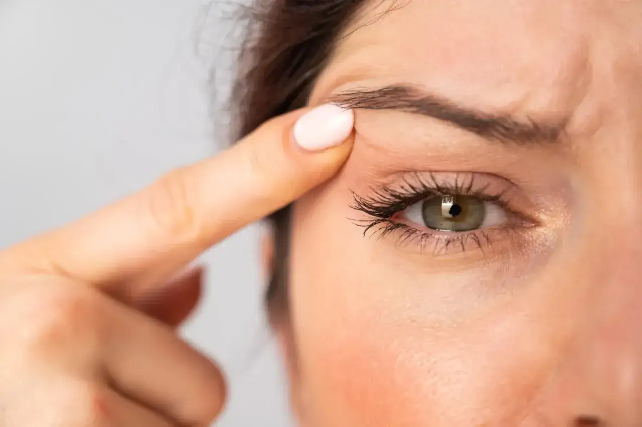 En kvinna drar i huden vid &ouml;gat, som har hooded eyes.