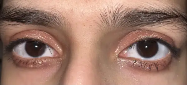 Närbild på ögon med glittrig douyin makeup i rosa toner. Ögonbrynen är mörka och buskiga.