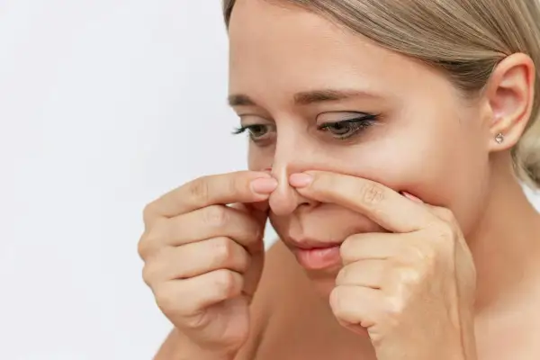 En kvinna undersöker sin näsa, där vita pormaskar syns tydligt.